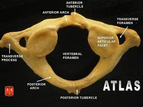 What is the Difference Between Atlas and Axis Vertebrae – Pediaa.Com