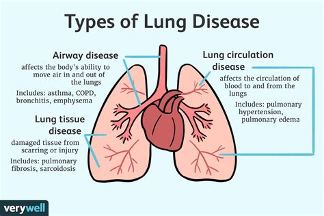 Common Respiratory Disorders and Their Impact on Lung Function | Health
