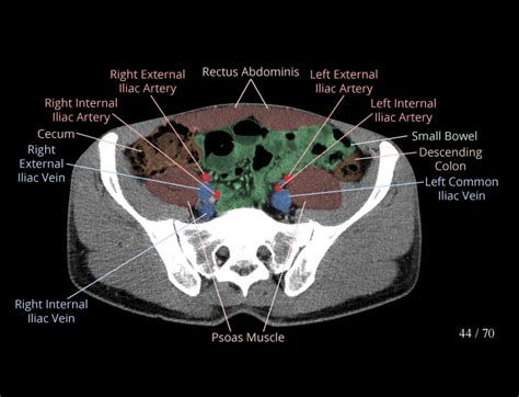 Abdomen And Pelvis: Normal Anatomy E-Anatomy, 41% OFF