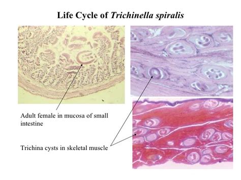 Trichurids