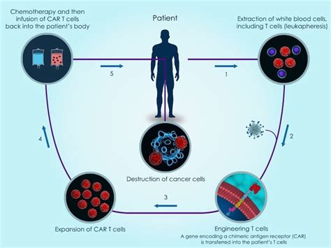 Four New Technologies That Will Change The Way Cancer Is Treated