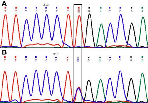 Molecular Vision: Kumar, Mol Vis 2011; 17:693-707. Figure 4