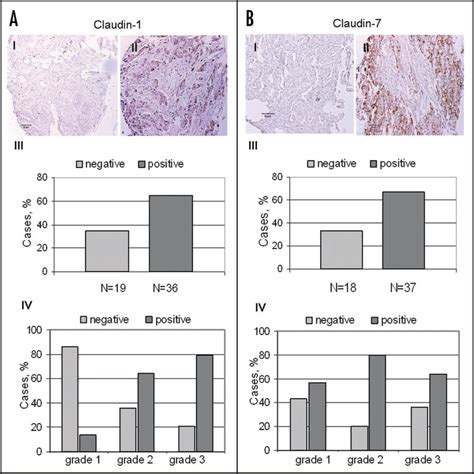 Claudin expression in breast cancer tissues: Claudin-1 (A) and ...