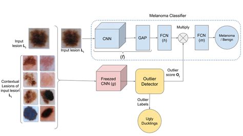 Proposed CAD system for melanoma detection | Download Scientific Diagram