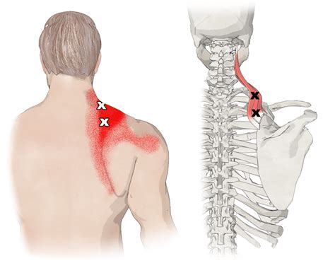 Levator Scapulae Muscle Function Trigger Points And Anatomy | Images and Photos finder