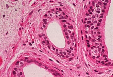 Basic Histology -- Cuboidal Epithelium, Two Layers | Smooth muscle ...