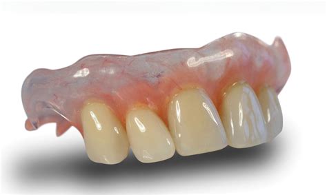 Valplast Upper - Dentures & Denture Repairs Swansea Cardiff UK | Romak Denture Centre