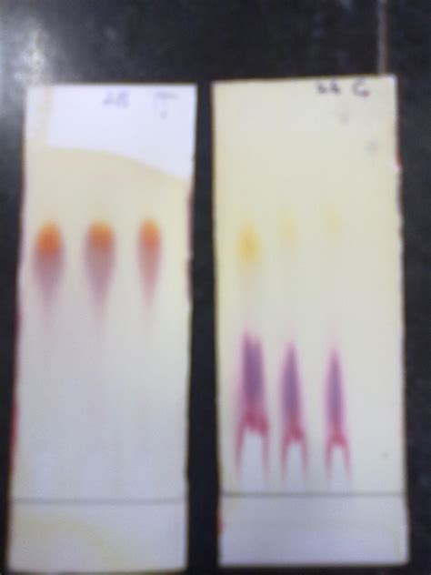 Applications and Advantages of Thin Layer Chromatography - Miles Scientific