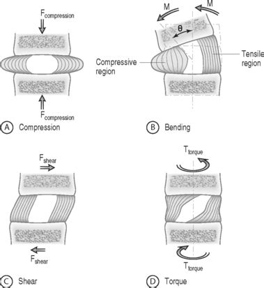 Biomechanics of the Intervertebral Disc | Clinical Gate