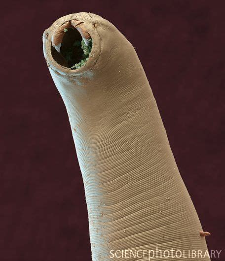 Hookworm. Coloured scanning electron micrograph (SEM) of the head of the parasitic nemat ...