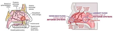 Epistaxis: What Is It, Types, Causes, Prevention,, 47% OFF