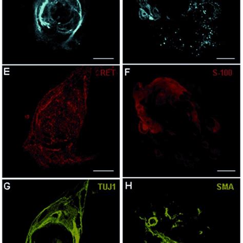 Characterization of neurospheres from human neural precursors cells ...