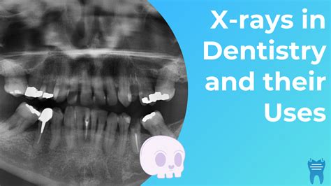 Types of Dental Radiographs and their Uses - dentalnotebook