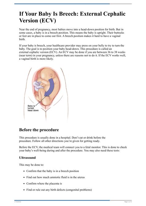 Text - If Your Baby Is Breech: External Cephalic Version (ECV ...