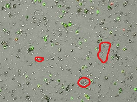 How to remove debris during preparing neuron cell suspension for single-cell RNA sequencing ...