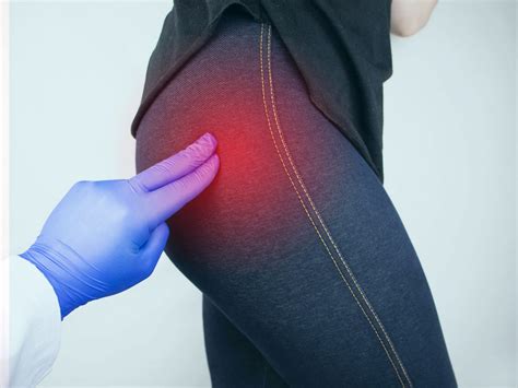 What causes buttock pain and what can be done about it?