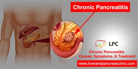 What Is Chronic Pancreatitis? Causes, Symptoms and ComplicationsLPC