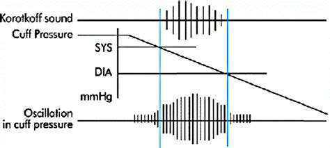 Oscillation amplitudes observed with the oscillometric method. | Download Scientific Diagram