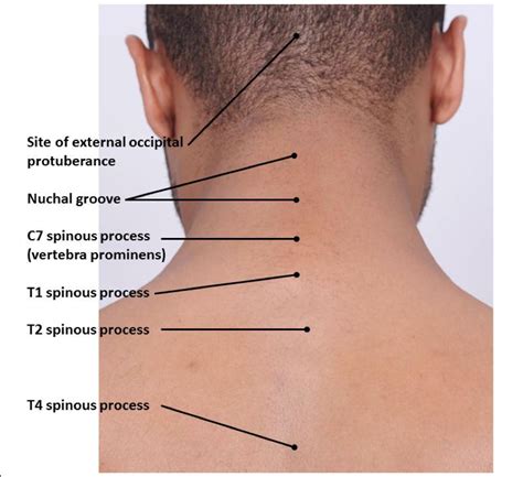 Lymph nodes base of back neck - whatholf