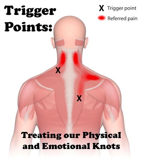 Pin on Acupressure points & trigger points