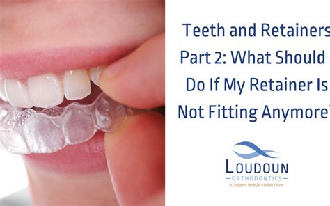 Teeth and Retainers Part 2: What Should I Do If My Retainer Is Not ...