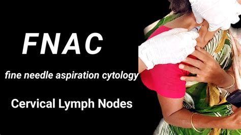 FNAC Of Cervical Lymph Nodes ।। - YouTube