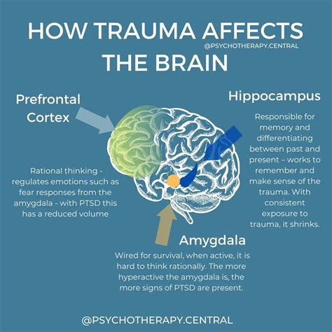 How trauma affects the brain – Artofit