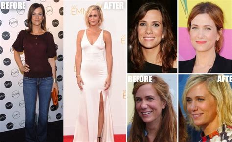 Kristen Wiig Before And After: Did The Saturday Night Live Star Undergo Plastic Surgery? En El Ajo