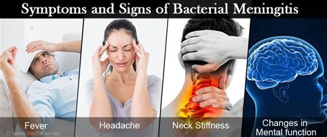 Bacterial Meningitis - Causes, Symptoms, Diagnosis, Treatment & Prevention