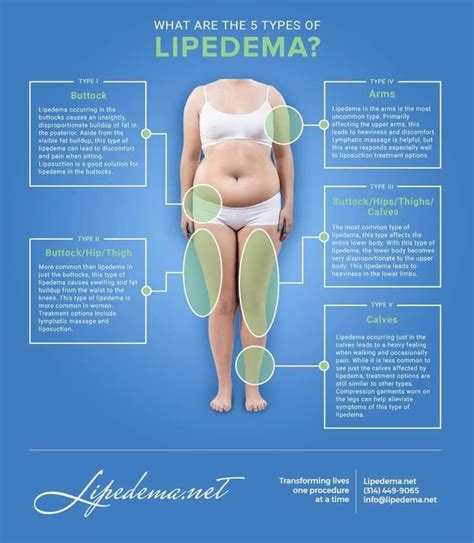 Pin by Isa Garijo on Lipedema | Lipedema, Lipedema treatment, Laser lipo