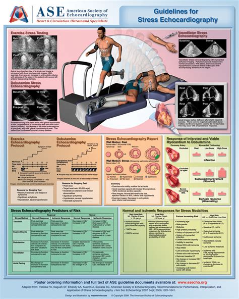 Medmovie.com | ASE Poster 5: Guidelines for Stress Echocardiography