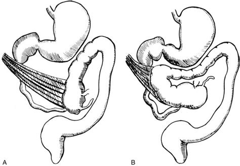 Congenital and Neonatal Abnormalities | Clinical Gate