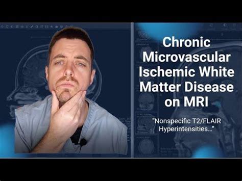 a man with his hand on his chin and the words chronic microvascular ...