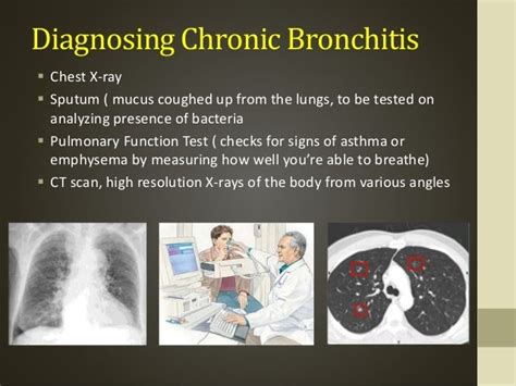 Chronic bronchitis & emphysema