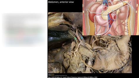 hepatoduodenal ligament Diagram | Quizlet