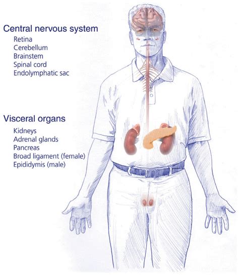 Von Hippel-Lindau Syndrome Screening And Diagnosis, 44% OFF