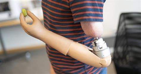 The Future of Prosthetics Might Be in This Mind-Controlled Bionic Arm