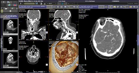 PACS — Insignia Medical Systems