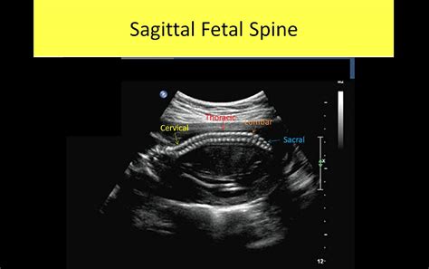 OB GYN Ultrasound Registry Review