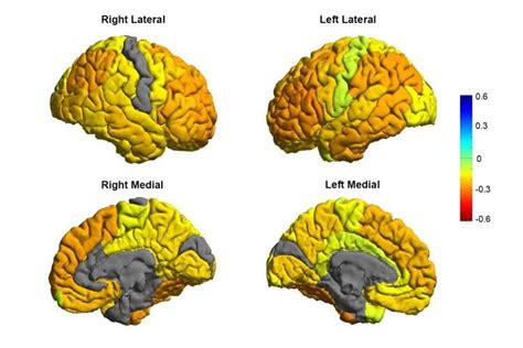 Researchers Create a Roadmap of Bipolar Disorder and How It Affects the Brain - Neuroscience News