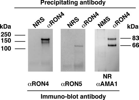 The PfRON4 and PfRON5 proteins form a complex with PfAMA1 in schizonts ...