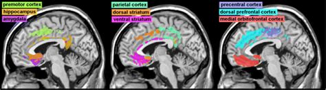 anterior cingulate cortex