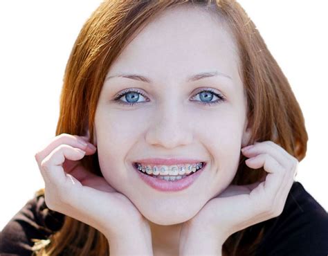 Teenage Orthodontics: Why Your Kids Need to Have Braces - Mom Does Reviews