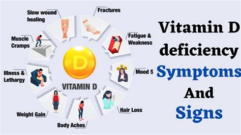 Vitamin d deficiency 12 symptoms cause and Vitamin D Deficiency Effects On The Body And Natural ...