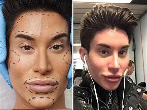 Human Ken Doll Talks Latest Plastic Surgery: Justin Jedlica Could've ...