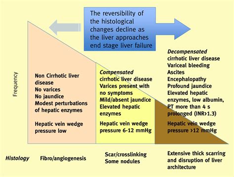 End stage liver disease - Paediatrics and Child Health