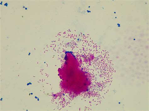 Micrograph Escherichia coli and Mycobacterium smegmatis acid fast 1000X ...