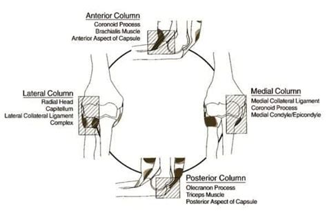 Elbow Dislocation • LITFL • Trauma Library