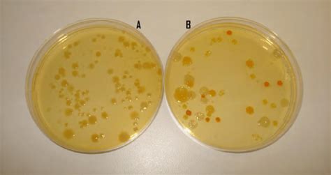 Tryptic Soy Agar Plate Recipe | Deporecipe.co