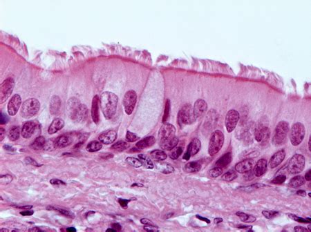 2-25 Tecido epitelial de revestimento - HISTOLOGIA